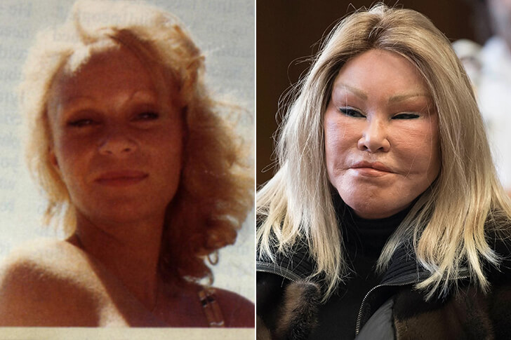 Jocelyn Wildenstein