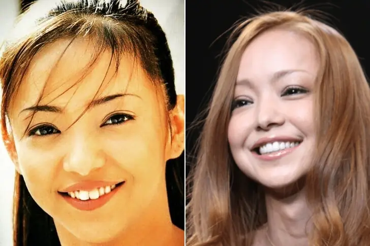 安室奈美恵