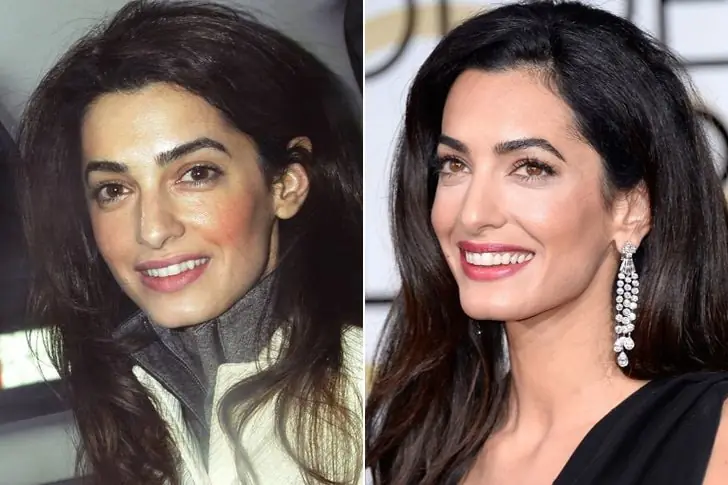 Amal Clooney – Doughty Street Chambers Barrister