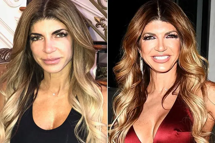Teresa Giudice