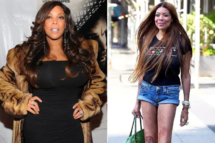 Wendy Williams – Lost 50 Pounds Through Healthy Eating And Pilates
