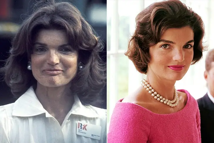 Jackie Kennedy – Ex primeira dama americana