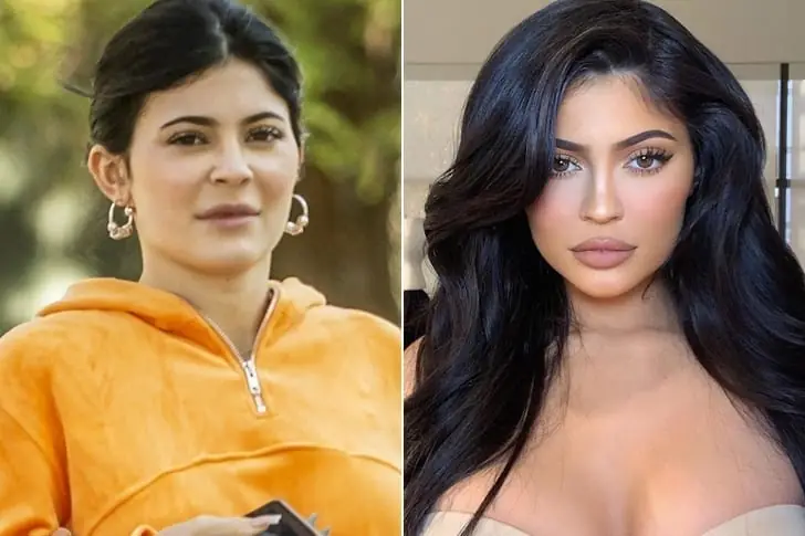 Kylie Jenner