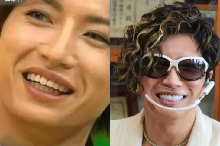 Gackt