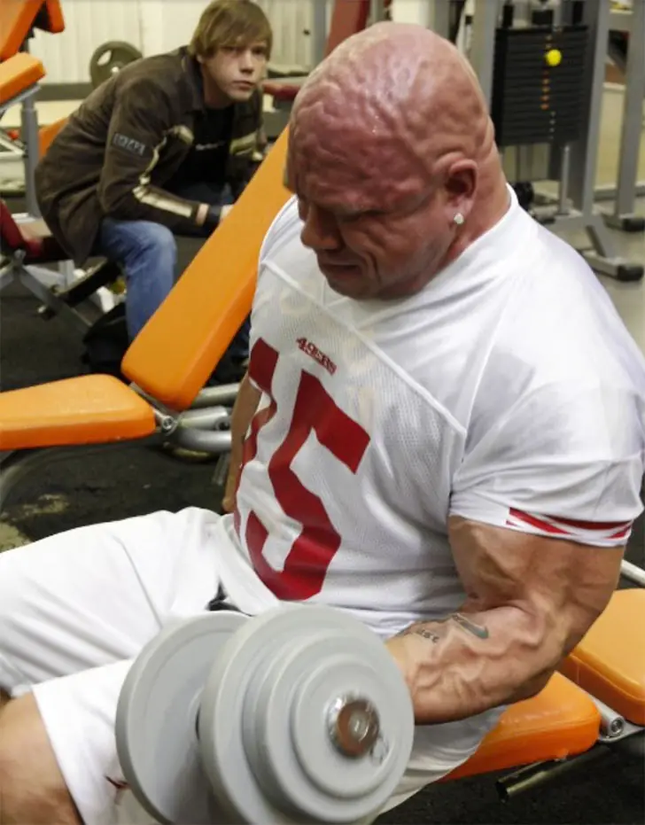 Veins Pop, Curiosity Piqued