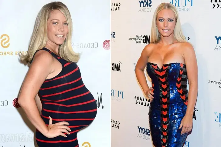 Kendra Wilkinson – Lost 55 Pounds By Working Out And Following The Atkins Diet