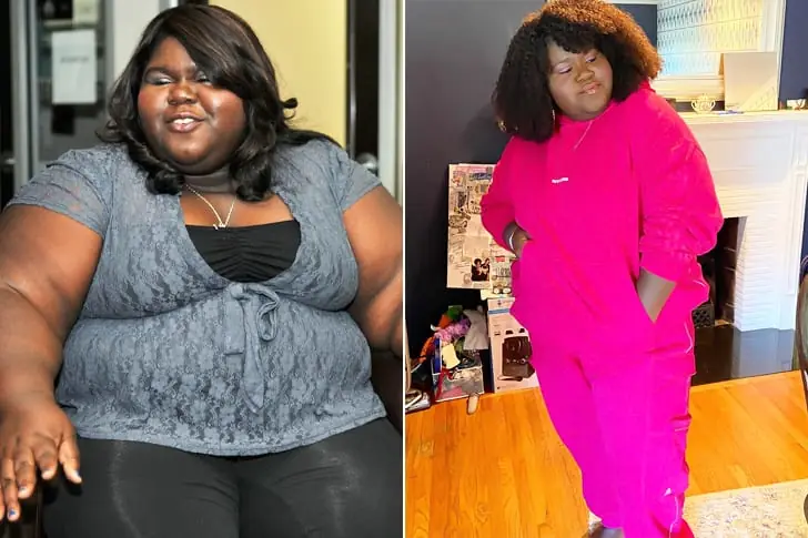 Gabourey Sidibe – Lost 150 Pounds Through Weight Loss Surgery And Healthier Lifestyle